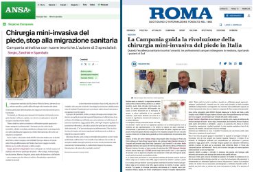 2 ansa roma napoli dott fabrizio sergio alluce valgo più interventi in italia 25000 interventi alluce valgo miniinvasivo metatarsalgia fascite plantare spina dito a martello