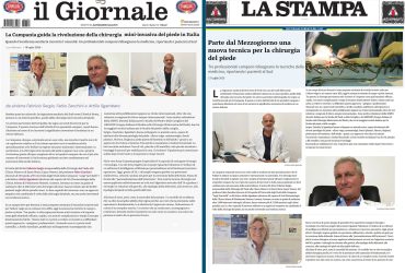 3 il giornale la stampa dott fabrizio sergio alluce valgo più interventi in italia 25000 interventi alluce valgo miniinvasivo metatarsalgia fascite plantare spina dito a martello