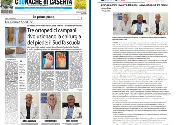 6 cronache di caserta casertace dott fabrizio sergio alluce valgo più interventi in italia 25000 interventi alluce valgo miniinvasivo metatarsalgia fascite plantare spina dito a martel