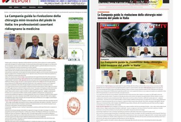 9 voce del meridione dott fabrizio sergio alluce valgo più interventi in italia 25000 interventi alluce valgo miniinvasivo metatarsalgia fascite plantare spina dito a martello